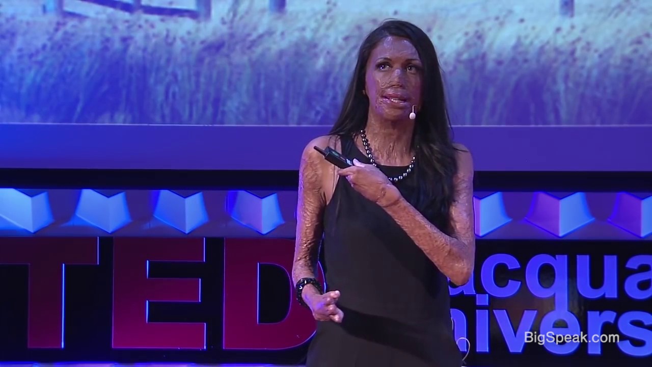 Unmask your potential Turia Pitt BigSpeak Motivational Speakers